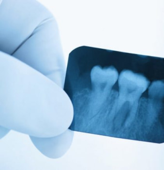 Рентген зубов в калининграде