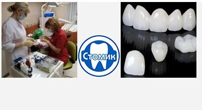 Особенности реставрации зубов и опыт стоматолога
